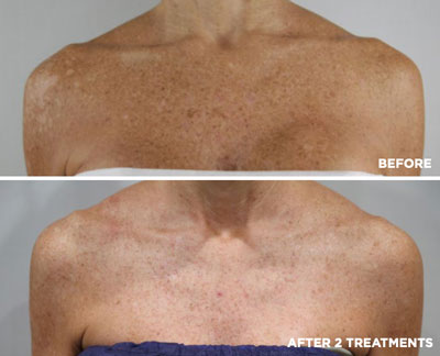 vipeel body soho nyc